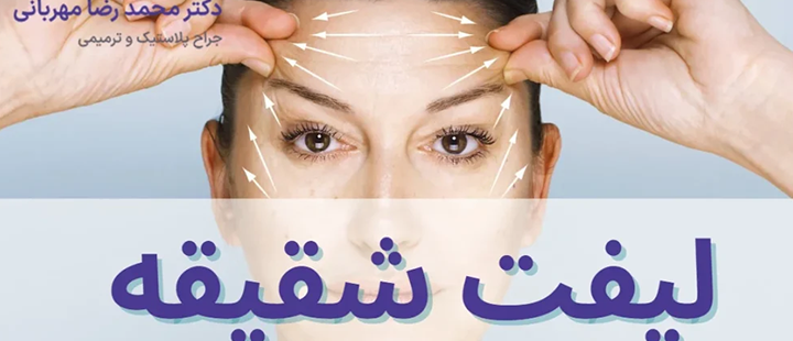 درباره لیفت شقیقه 