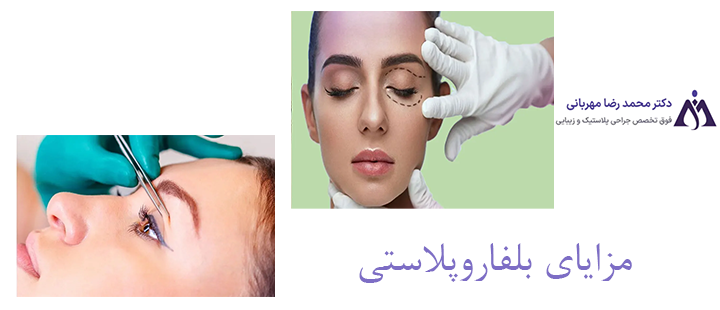 مزایای بلفاروپلاستی 