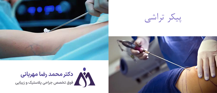 درباره پیکرتراشی