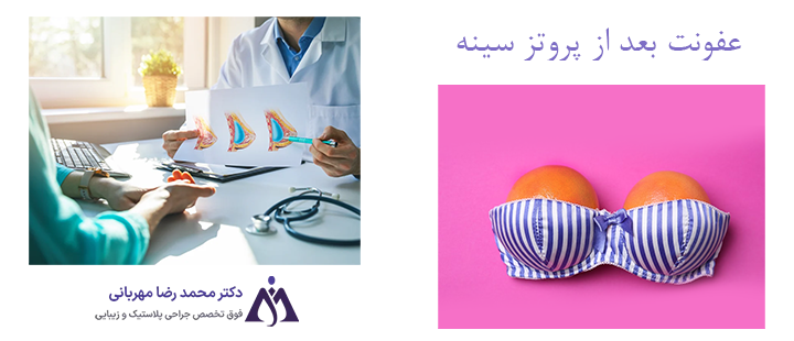 عفونت بعد از پروتز سینه چه علائمی دارد؟
