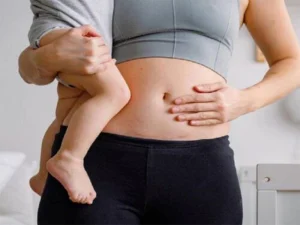 لیپوماتیک بعد از زایمان